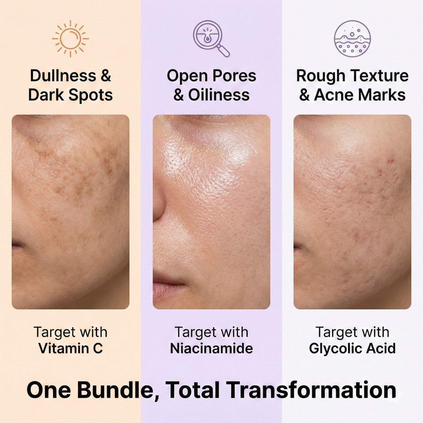 Spotless Glow Deal – 3-Step Serum Kit for Acne Marks, Pores & Brightening