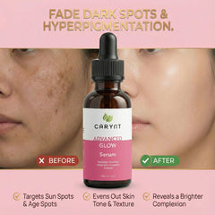 Advanced Glow Serum – Brightens Skin & Reduces Dark Spots - 30ml