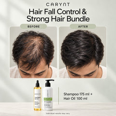 CARYNT Hair Fall Control & Strong Hair Bundle
