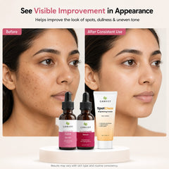 Pigmentation Repair Bundle – Dark Spot & Glow Care