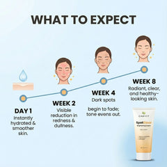 SpotClear Brightening Cream: Kojic Acid, Azelaic Acid & Retinol (50g)