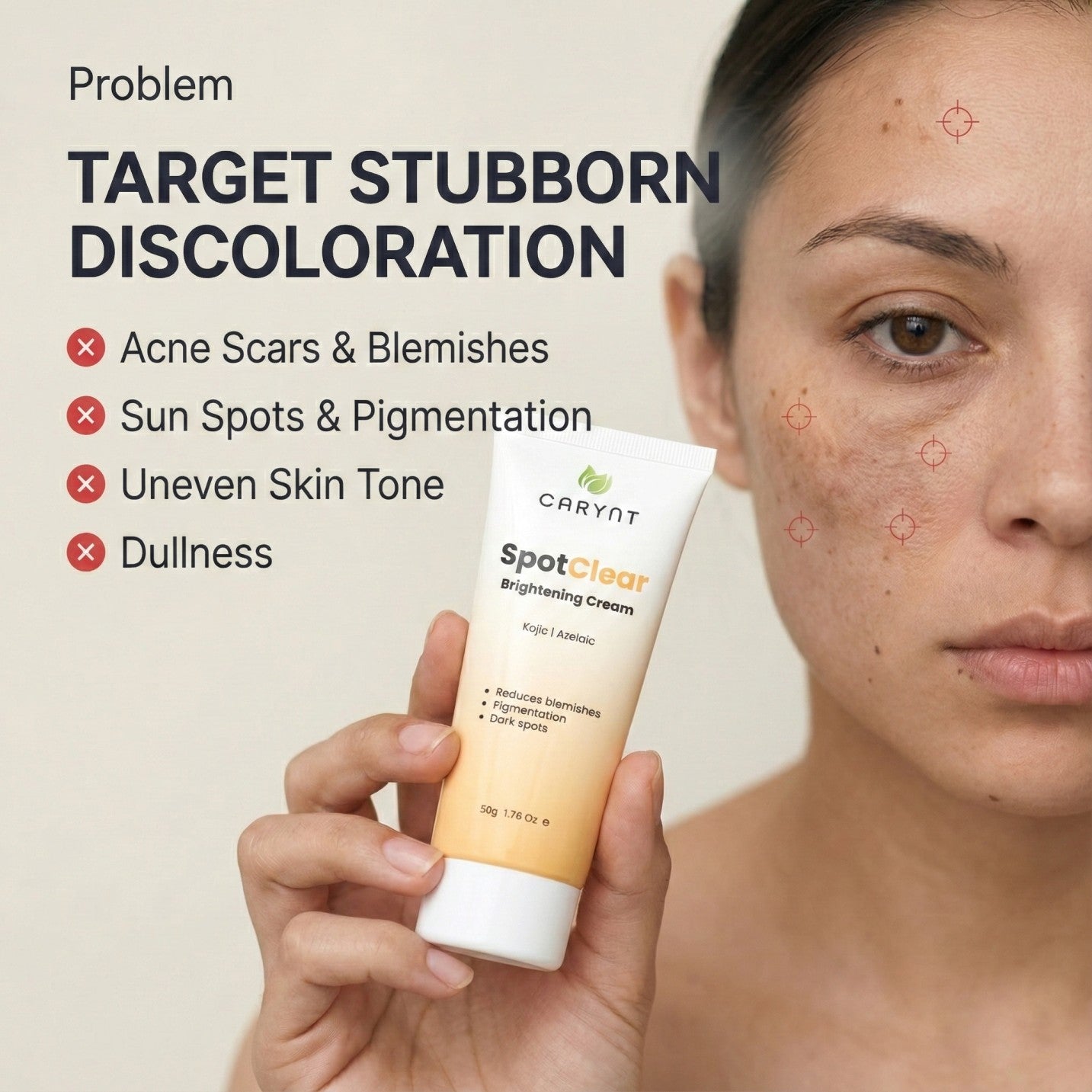 SpotClear Brightening Cream: Kojic Acid, Azelaic Acid & Retinol (50g)