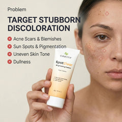 SpotClear Brightening Cream: Kojic Acid, Azelaic Acid & Retinol (50g)